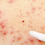 ОГЛАСИЛИ СЕ ИЗ БАТУТА: Тиче се МАЛИХ БОГИЊА